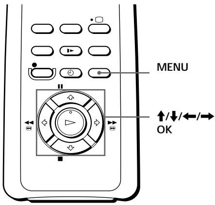 SONY SLV-SE60AE2 - Vorbereitungen - 1