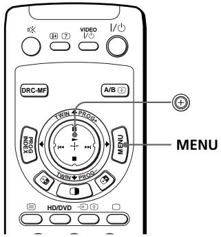 SONY KP-FS43M61 - Changement du réglage "PICTURE" - 1
