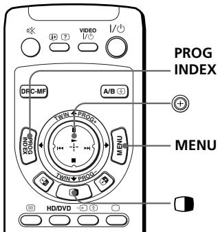 SONY KP-FX53M61 - Changing the "MULTI PICTURE" setting - 1