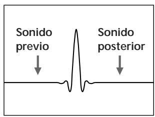 Sonido previo Sonido posterior
