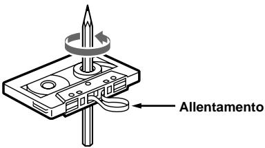 SONY XR-L500 - Cura delle cassette - 1
