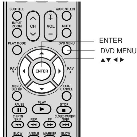 TOSHIBA 20HLV86 - Remarque: - 1