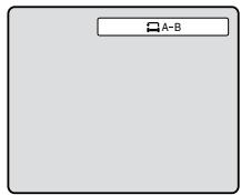 TOSHIBA 20HLV86 - Lecture à répetition A-B DVD VCD - 2