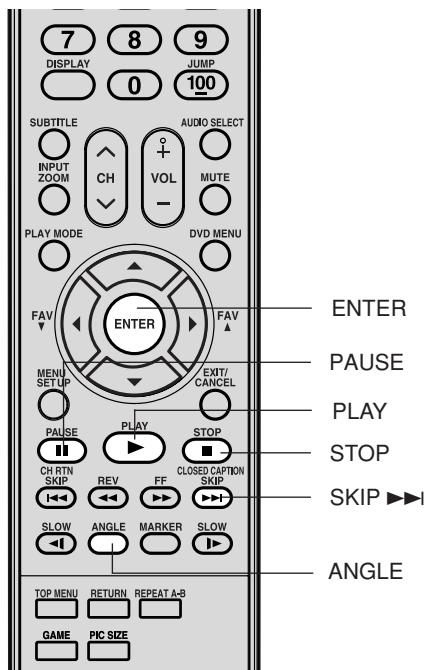 TOSHIBA 20HLV86 - Remarque: - 1
