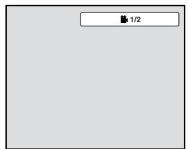 TOSHIBA 20HLV86 - Modifications des angles DVD - 1