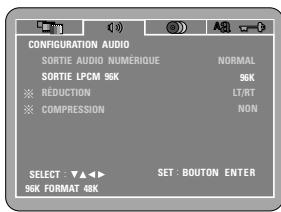 DENON DVD-770SD - REMARQUE: - 1