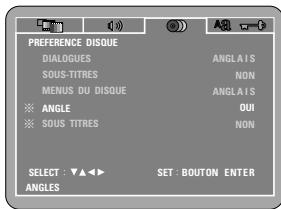 DENON DVD-770SD - AUTRE - 1