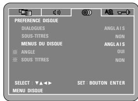DENON DVD-770SD - AUTRE - 1