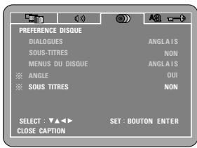 DENON DVD-770SD - NON - 1
