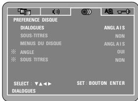 DENON DVD-770SD - REMARQUE: - 1