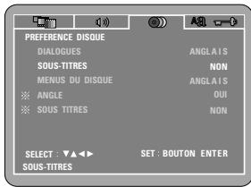 DENON DVD-770SD - AUTRE - 1
