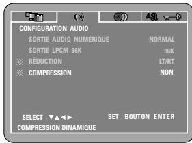 DENON DVD-770SD - STEREO - 1