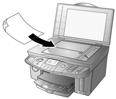 PHILIPS CRYSTAL 650 - Scanner - 2