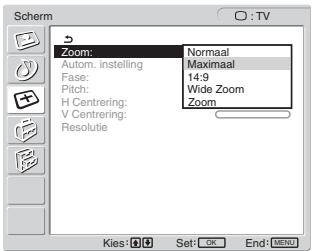 SONY MFM-HT205 - Tip - 1