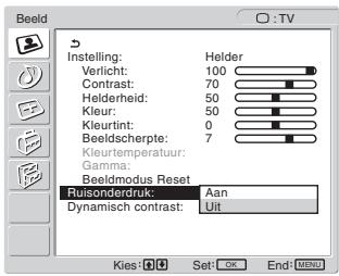 SONY MFM-HT205 - Druk op de ↑/↓ toetsen om "Ruisonderdruk" te selecteren en druk op de OK toets. - 1