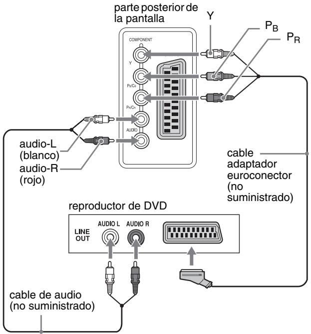 SONY MFM-HT205 - ■ Conexión de un equipo de vídeo mediante las tomas COMPONENT - 2