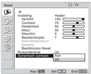 SONY MFM-HT205 - Druk op de ↑/↓ toetsen om "Dynamisch contrast" te selecteren en druk op de OK toets. - 1