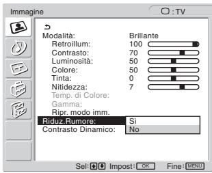 SONY MFM-HT205 - Sintonia fine della temperatura di colore - 4