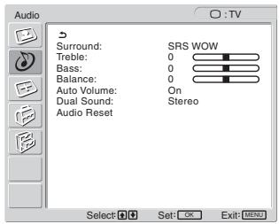 SONY MFM-HT205 - Tip - 1