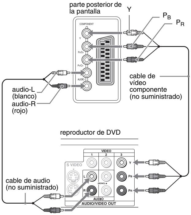SONY MFM-HT205 - ■ Conexión de un equipo de vídeo mediante las tomas COMPONENT - 1
