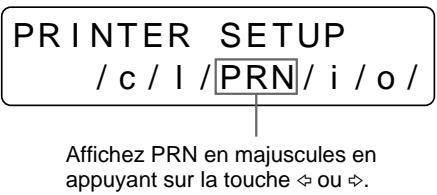 SONY UP-51MD - Réglage de la tonalité des tirages - 3