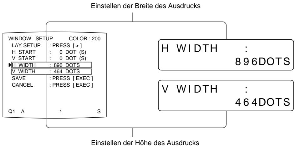 SONY UP-51MD - Wenn ein schwarzer Rand erscheint oder das Bild teilweise abgeschritten ist - 1