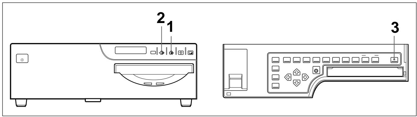 SONY UP-51MD - Before deleting images - 1