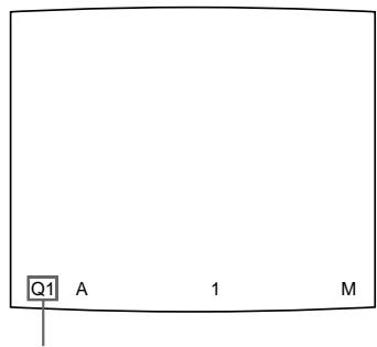 SONY UP-51MD - Press the PRINT button. - 1