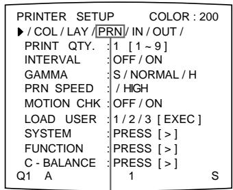 SONY UP-51MD - Remarque - 2