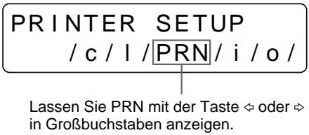 SONY UP-51MD - Einstellen des Farbtons der Ausdrucke - 3
