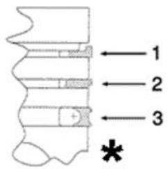 PIAGGIO XEVO - Piston rings - 1