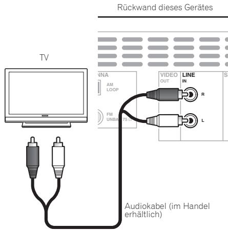 PIONEER X-CM31-W - Hinweis - 1