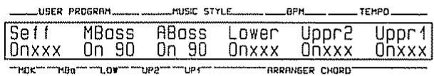 ROLAND E-70 - LOWER BALANCE - 3