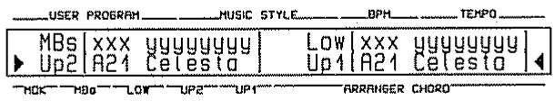 ROLAND E-70 - UPPER 1 + UPPER 2 TONE SELECT - 2