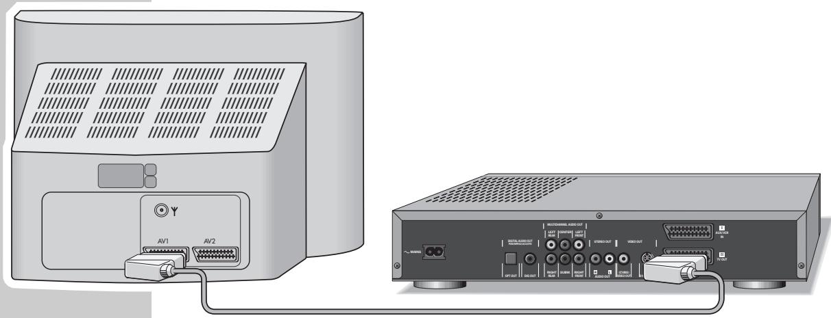 GRUNDIG GDV 200 - Remarque : - 1