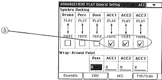 KORG I30 - Utilisation de la fonction synchro backing - 1