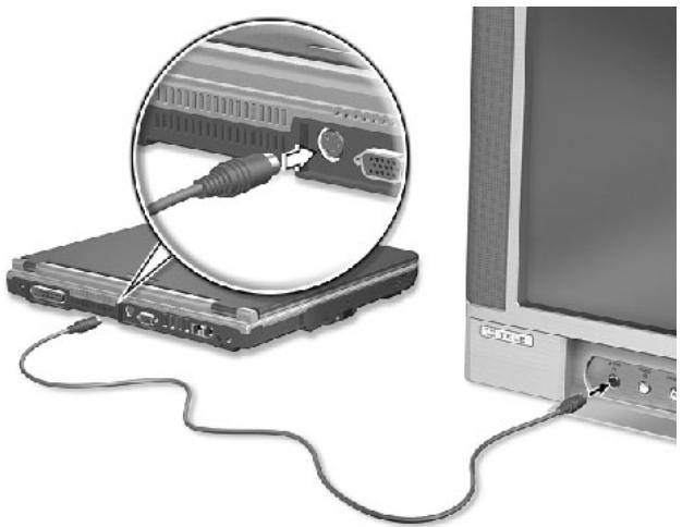 MEDION BDAWID2000 - Branchement d'un televiseur - 1