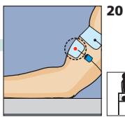 COMPEX MI-FITNESS TRAINER - Placement des électrodes et position du corps - 2