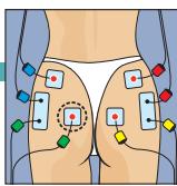 COMPEX MI-FITNESS TRAINER - Placement des électrodes et position du corps - 1