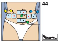 COMPEX MI-FITNESS TRAINER - Placement des électrodes et position du corps - 2