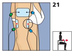 COMPEX MI-FITNESS TRAINER - Placement des électrodes et position du corps - 3