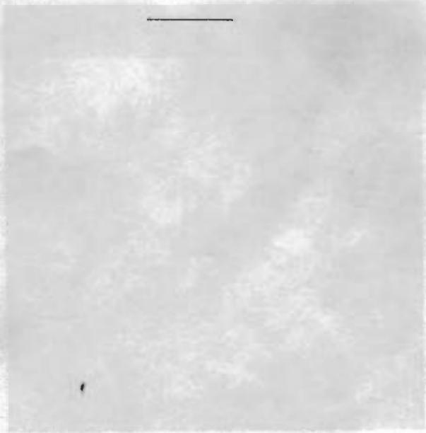 PORSCHE 924 - DEPOSE ET REPOSE DU DISTRIBUTEUR D'ALLUMAGE - 4