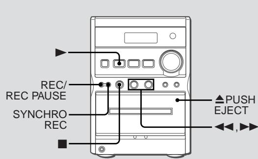 AIWA XR-EM20 - Graves et aigus - 1