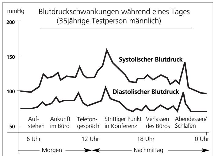 IBP MEDIPRO 100FN - über den Blutdruck 3 - 1
