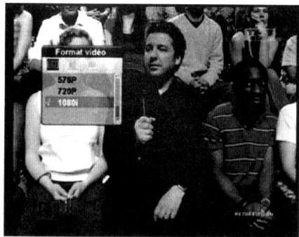 VEA THD 100 - Aspect de la vente - 1