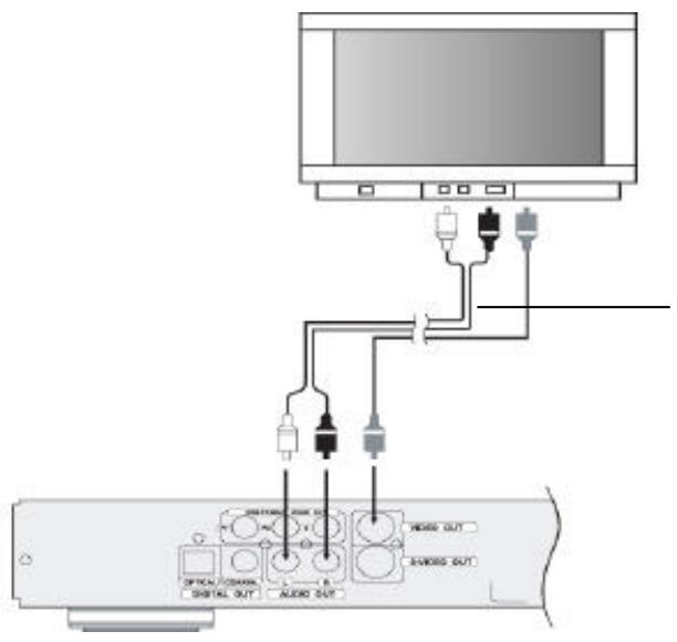 VIETA DVD-4 - Conexión de video compuesto - 1
