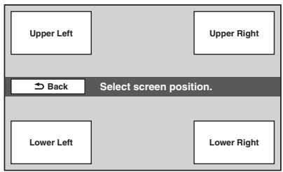 SONY XNV-L77BT TOMTOM - Lors de la sélection de « Dual Screen Navi + A/V (Large) » ou de « Dual Screen Navi + A/V (Small) » - 1