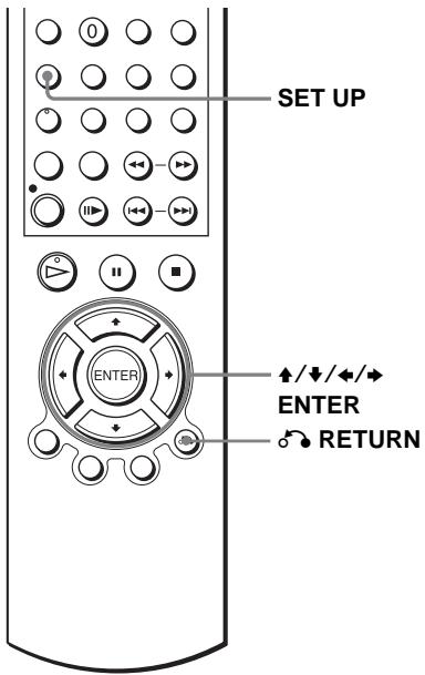 SONY SLV-D950GI - Before you start... - 1