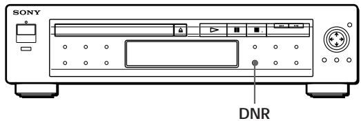 SONY DVP-S3000 - Reducing the Picture Noise (DNR: Digital Video Noise Reduction) - 2