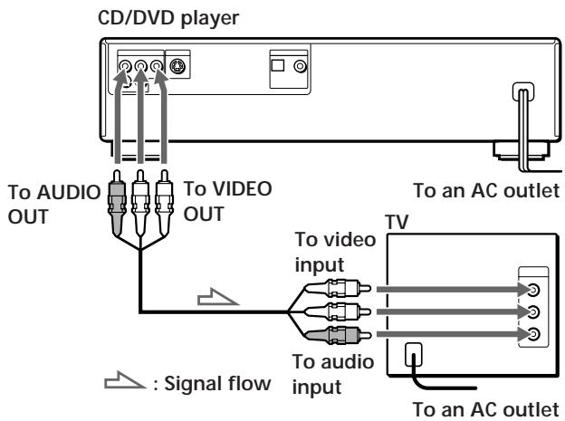 SONY DVP-S3000 - Overview - 1